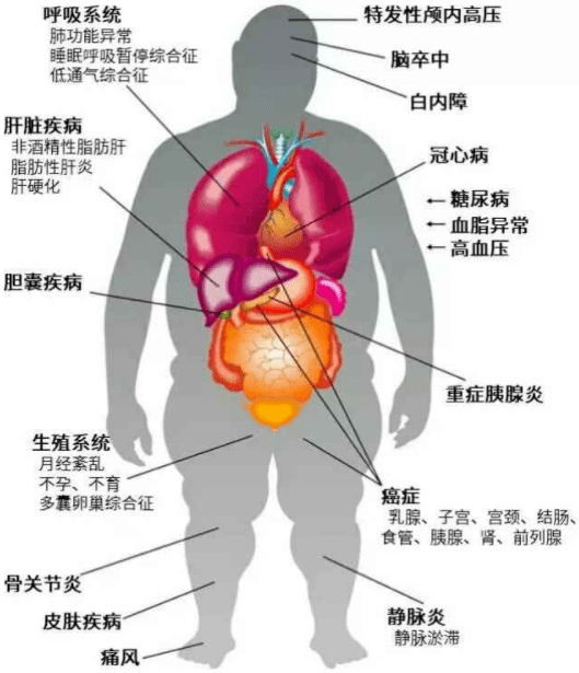 11种伤人疾病都与肥胖有关