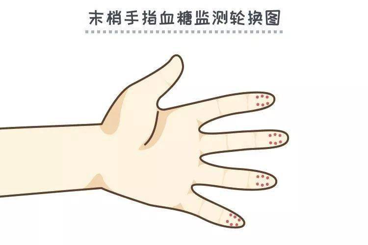 测血糖用第一滴血还是第二滴血? 到底哪个正确?_试纸_影响_的结果