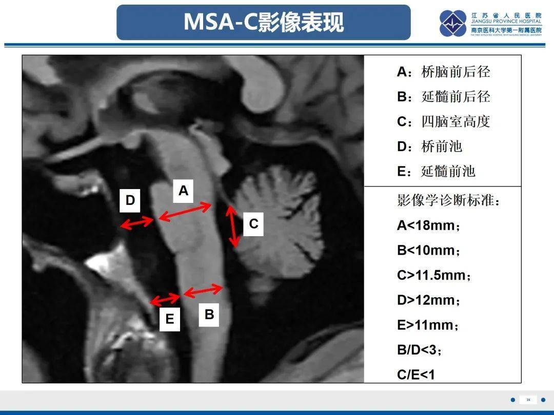 橄榄体解剖图片