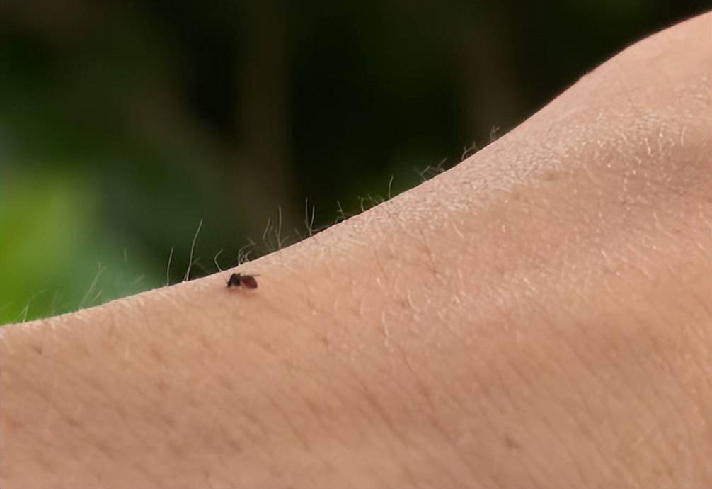 有人被咬后进急诊,这"小虫"公园,路边常见_蠓虫_蚊子_症状