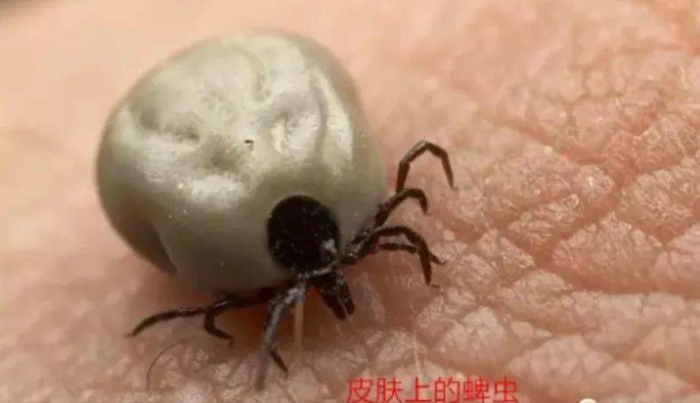 蜱虫是蛛形纲动物,可以传播一百多种疾病.