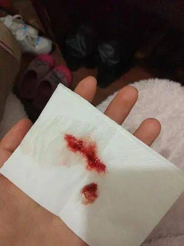 癌症来临并非无声无息,身体出现5种变化,有可能是癌症前兆?