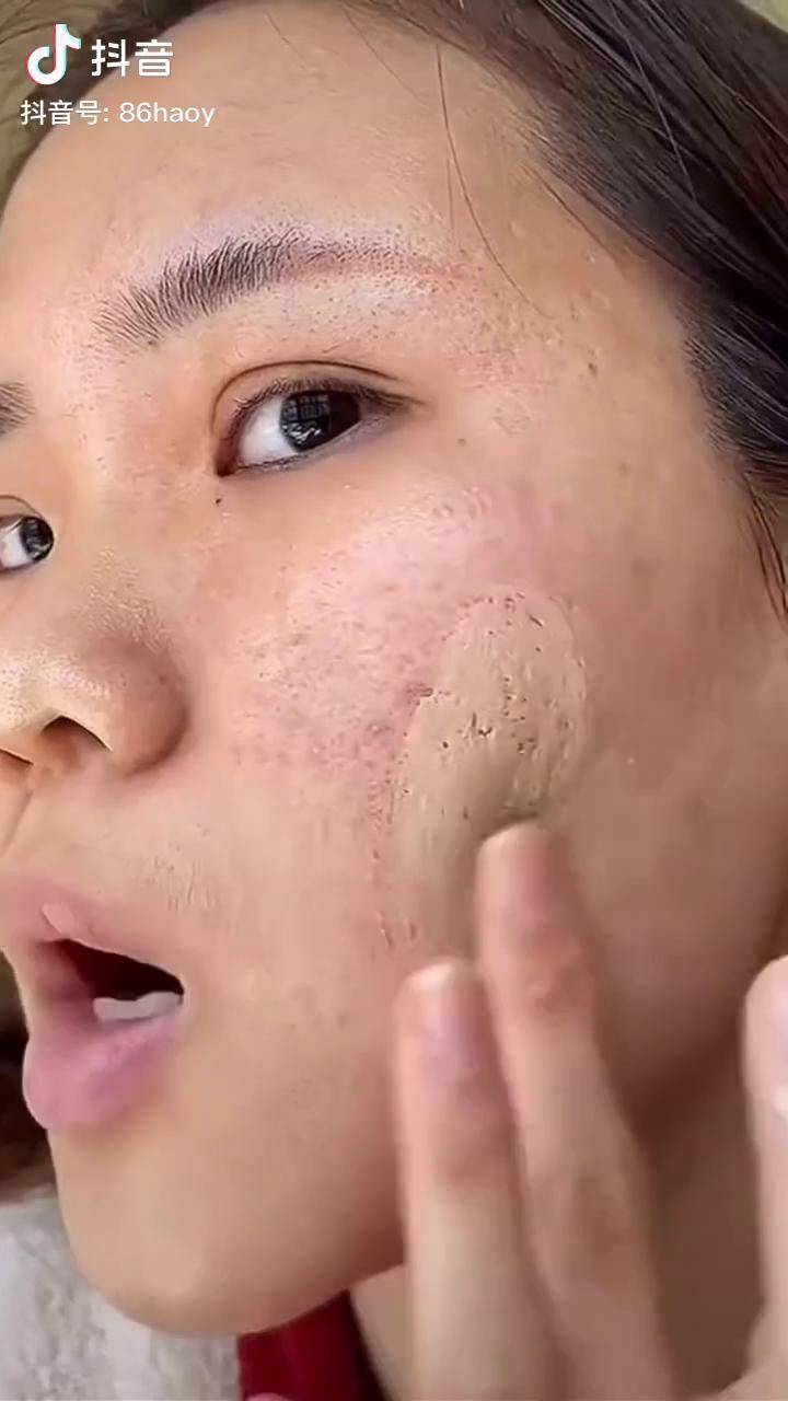 皮肤吸收不好,浮粉卡粉,毛孔粗大,起皮粗糙的姐妹赶紧热敷 起来,一次
