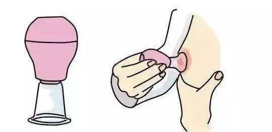 乳头凹陷,短平,过大——宝宝不爱吃该如何破解?_妈妈_乳晕_奶水