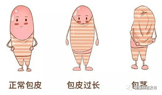 【健康课堂】解决萌宝“男”题 暑假正当时_割包皮_手术_孩子