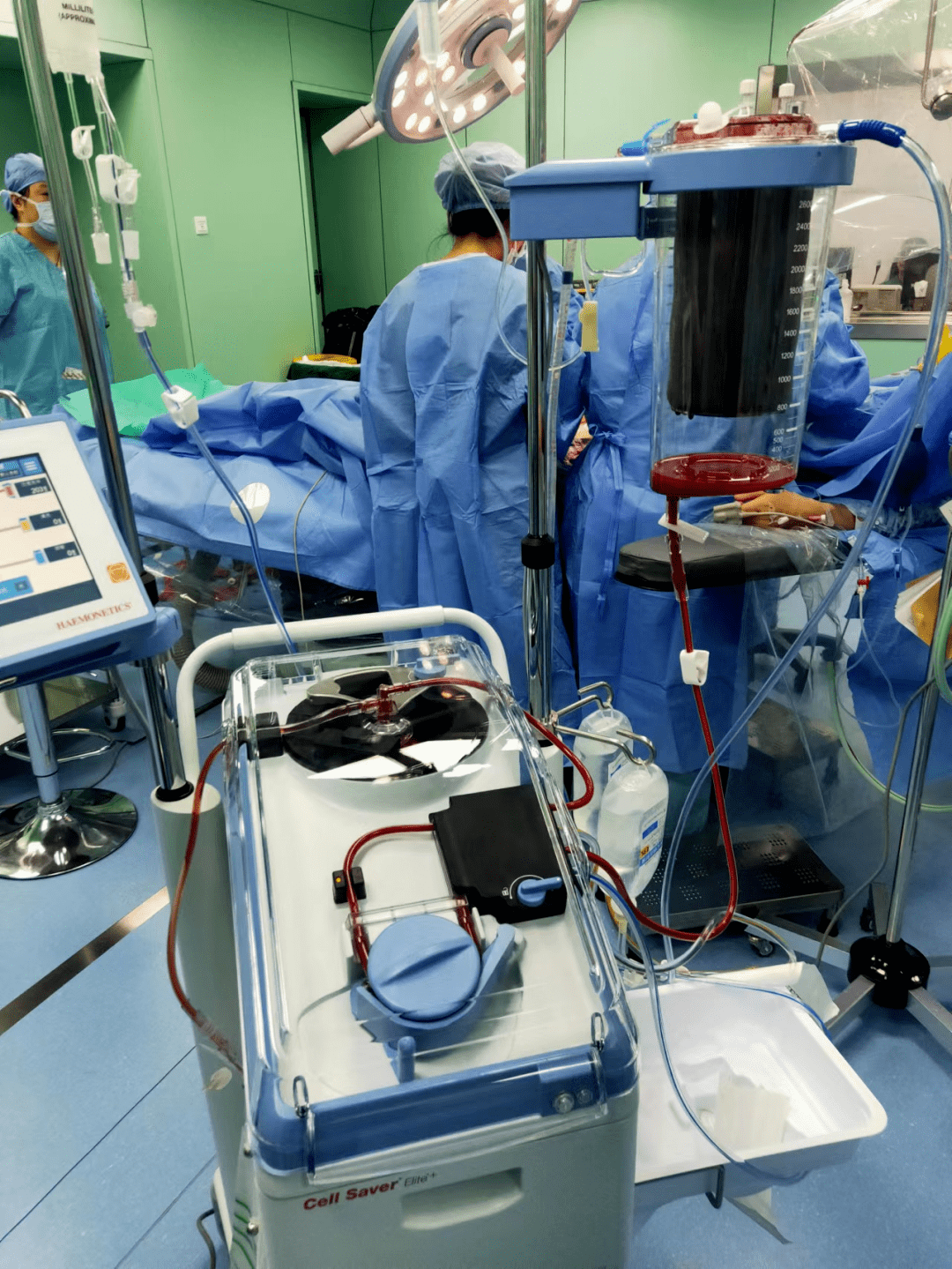 连妇幼首例凶险性前置胎盘自体血回输手术成功