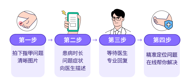 指甲总往肉里长,结果我得了这种病……_医生_手指_治疗