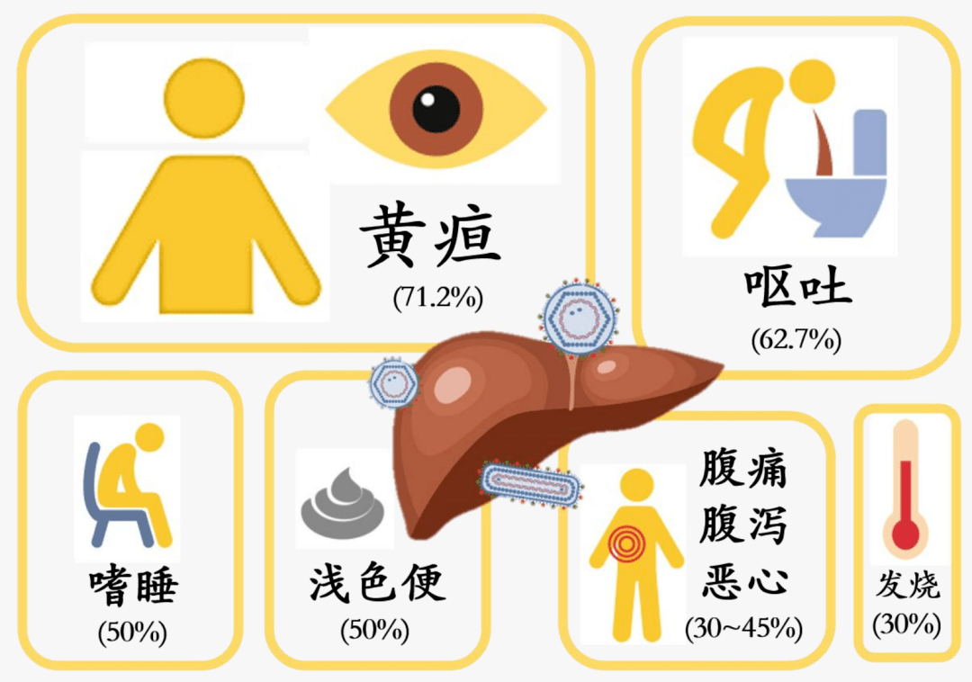 不明原因儿童急性严重肝炎病例的常见临床症状(统计数据来源于2022年