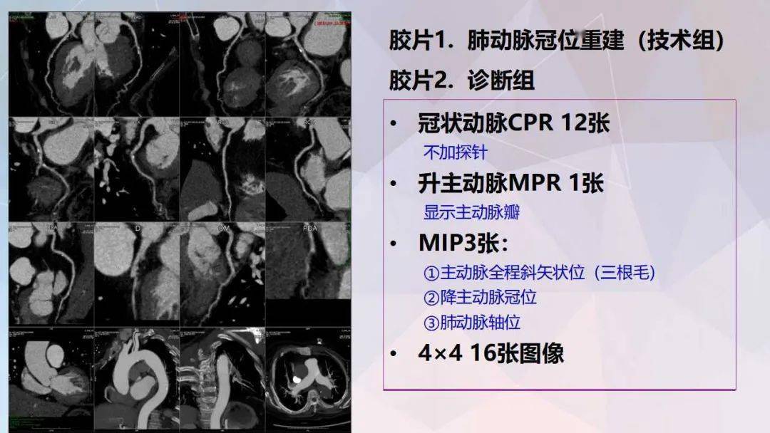 冠脈及胸痛三聯cta重建規範及報告模板