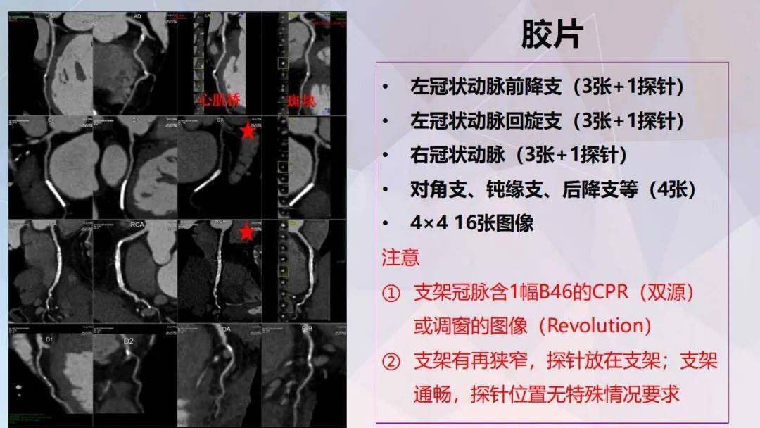 冠脉及胸痛三联cta重建规范及报告模板