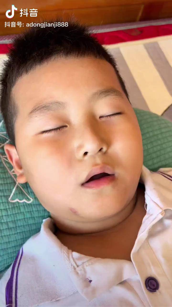 孩子张嘴睡觉一定要纠正不然长大了会很丑很丑的闭嘴贴母婴好物孩子