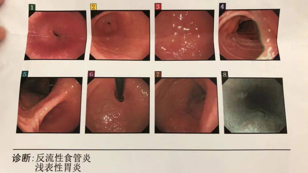 胃病医院检查单图片图片