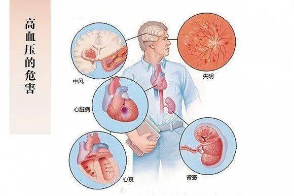 高血压与心血管风险