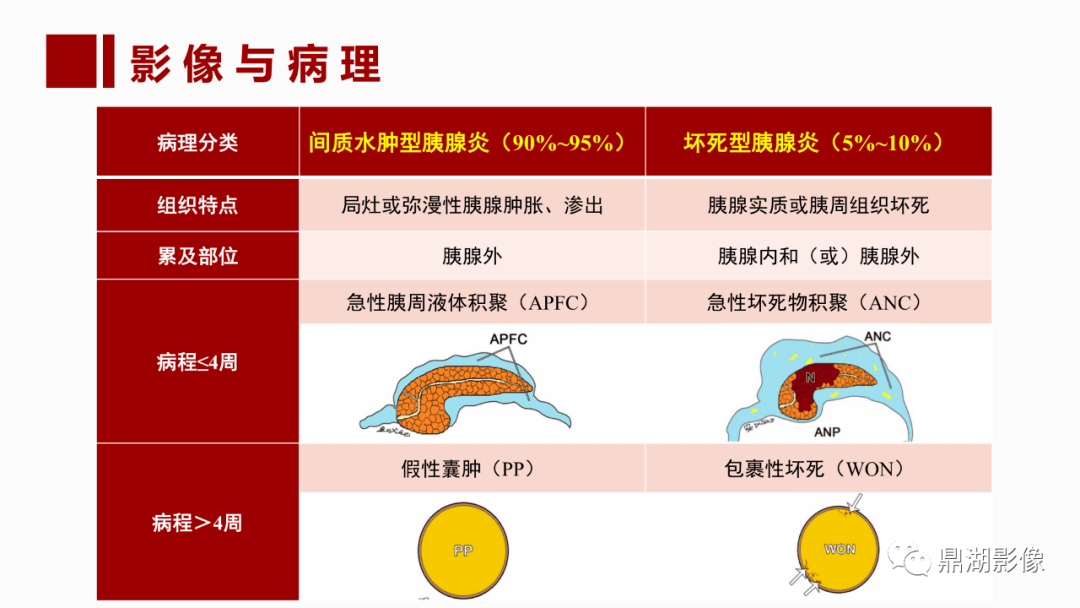 胰腺标准测量图片图片