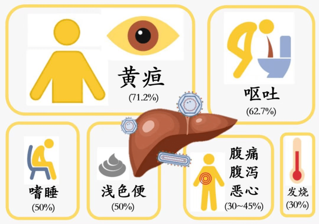 【知识】带你了解原因不明的不明原因儿童严重急性肝炎——7