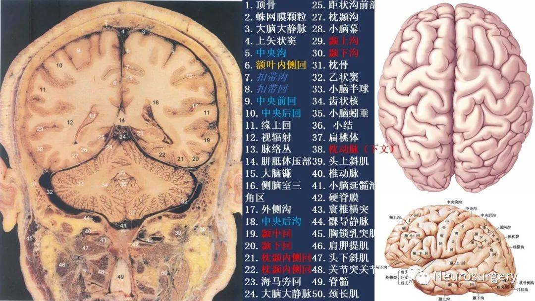 颅脑断层解剖图谱