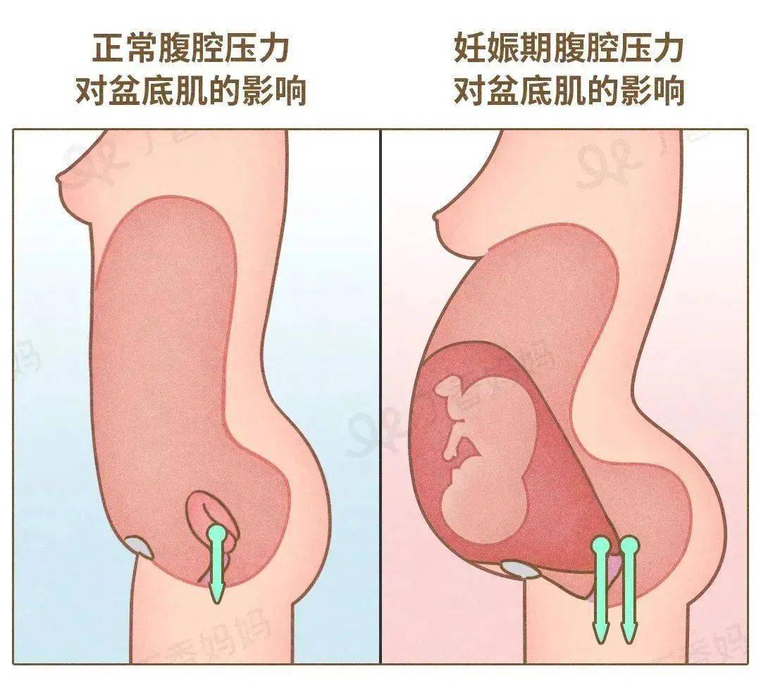 顺产后下面松弛图片