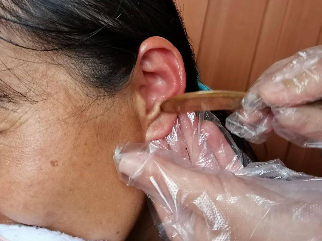 医疗服务提升中医护理展十八般武艺传承国粹守护患者健康