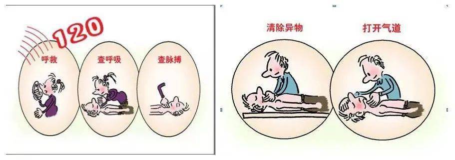ʃn]心肺复苏是针对心脏、呼吸骤停所采取的抢救措施。心肺复苏术的步骤：例句：cpr is a lif