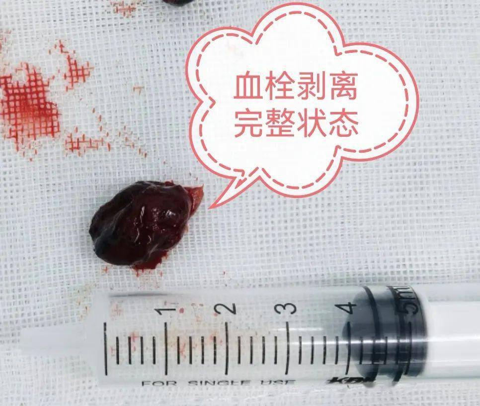 漳州肛肠科