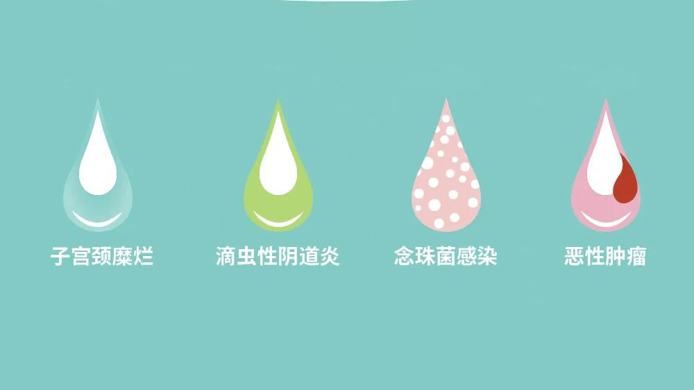 血性白带白带中混有血,应警惕宫颈癌,子宫内膜癌等恶性肿瘤的可能性