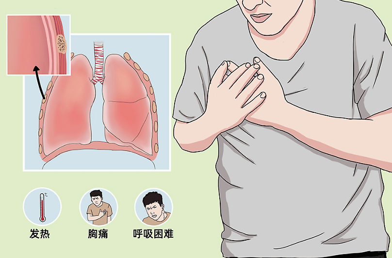 白血病胸痛位置图片