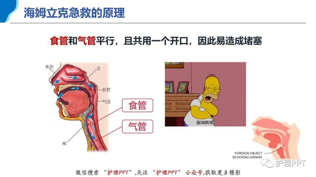 急性呼吸道堵塞图片