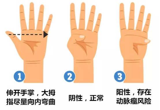 手指出现这个问题,可能是肿瘤信号!速查_青筋_症状_大拇指