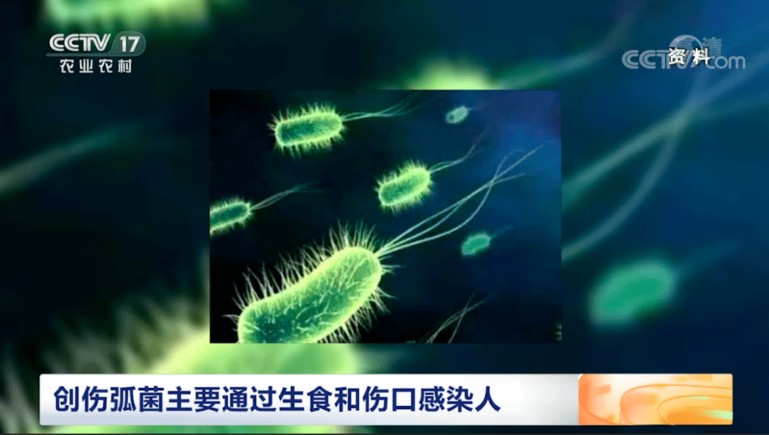 海洋创伤弧菌感染图片图片