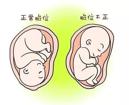 臀位剖宫产的步骤图片图片