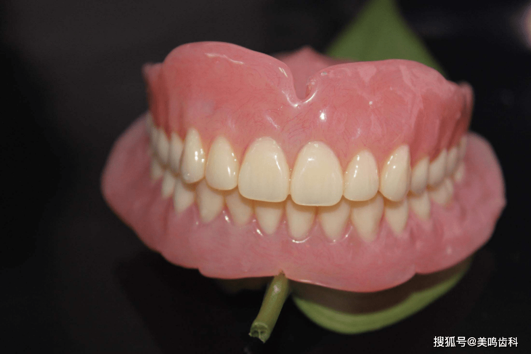 吸附性义齿即全口吸附性义齿,是目前目前较为先进的全口义齿制作系统.