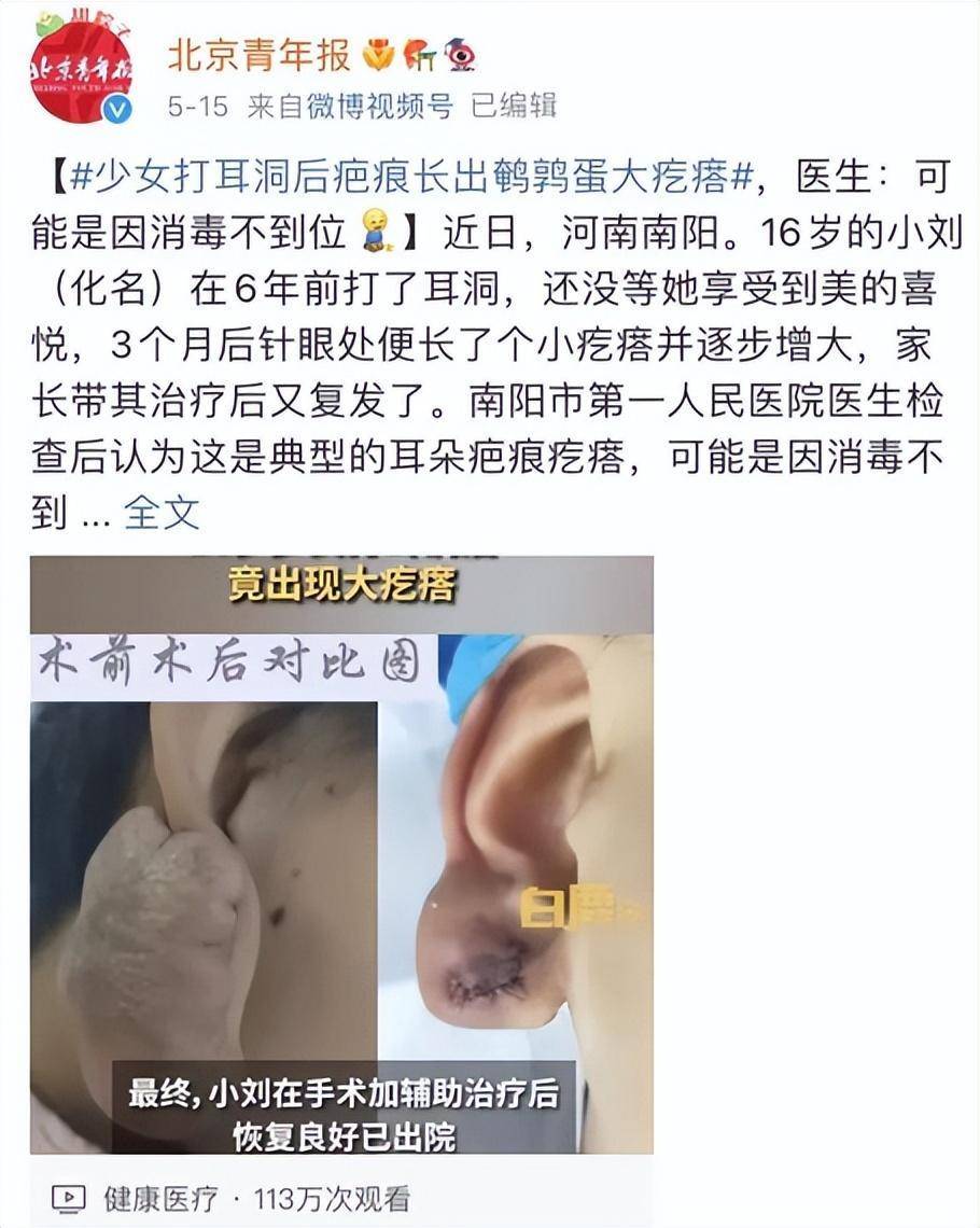 左右滑动查看更多耳朵这种"肉球疙瘩"的形状大小各异,遭遇的人也不少.
