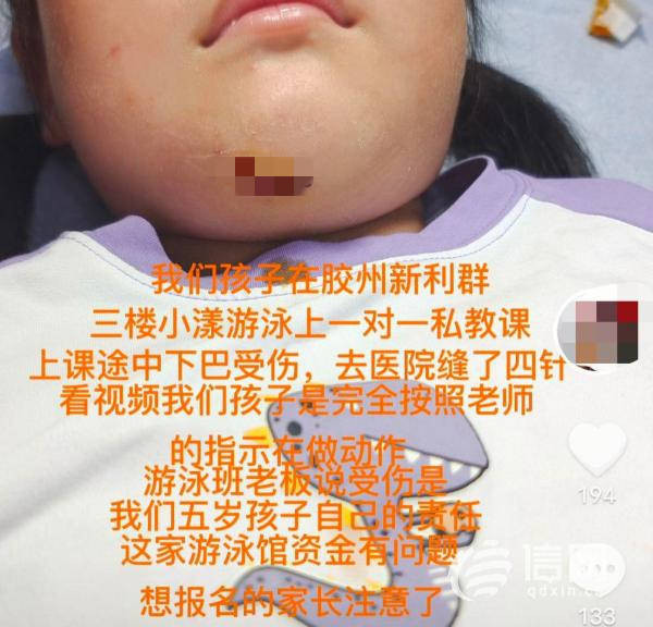 孩子在小漾游泳磕伤下巴 摔伤原因双方说法不一_冷女士_经营_胶州