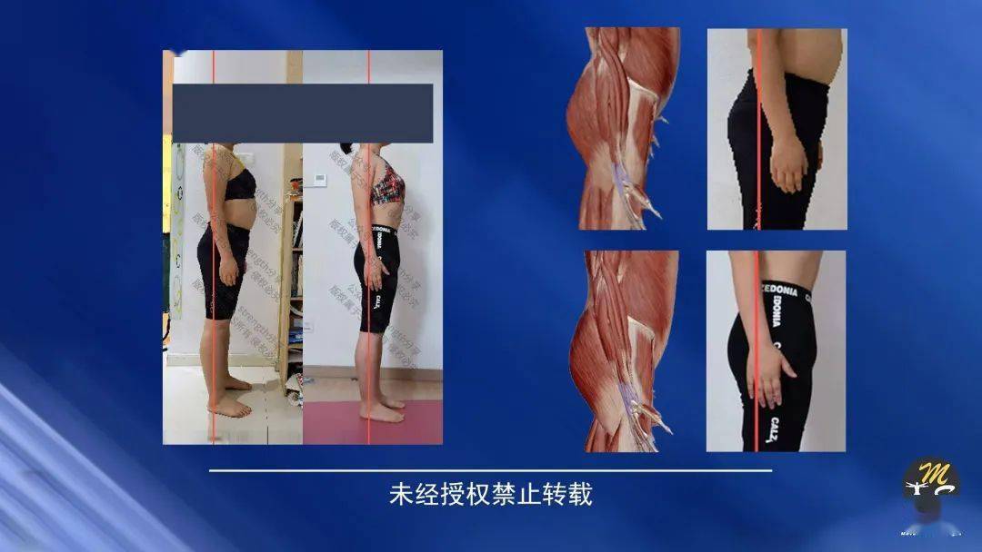 为什么杨达疗法会在康复界广为流传?_交叉_训练_扬达