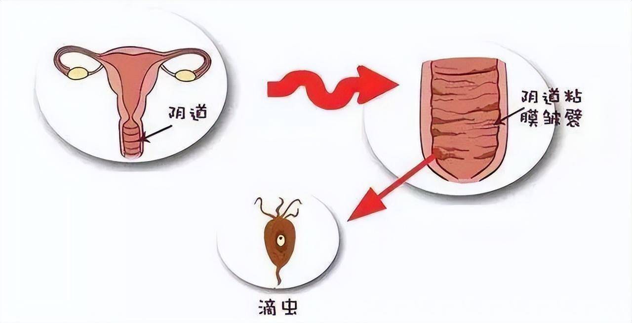 做好这三件事,远离难炎之隐