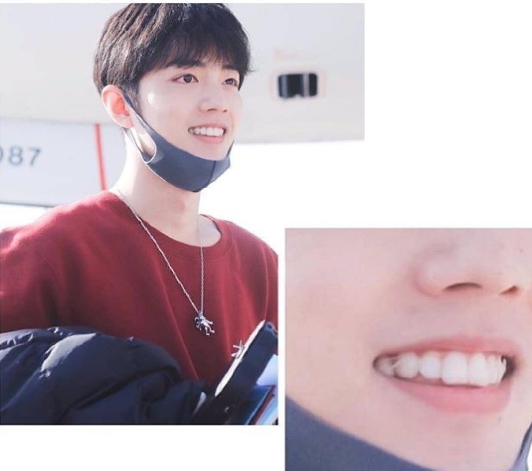 肖战坚持戴牙套两年,和出道时的他判若两人_牙齿_胡歌_杨幂