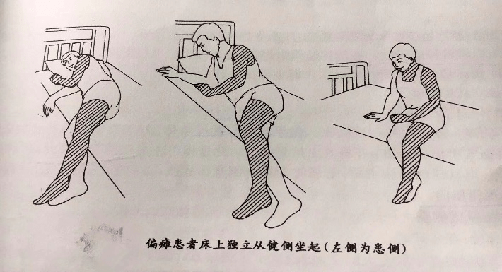 耳石症健侧卧位图解图片