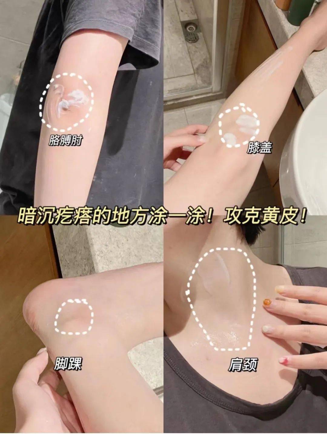 包含鸡皮肤穿裙子适合鞋子推荐的词条