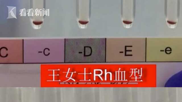 全球不到50例! 江苏发现2例全球罕见黄金血型 两人系亲姐妹_阴性_Rhc_Rhe