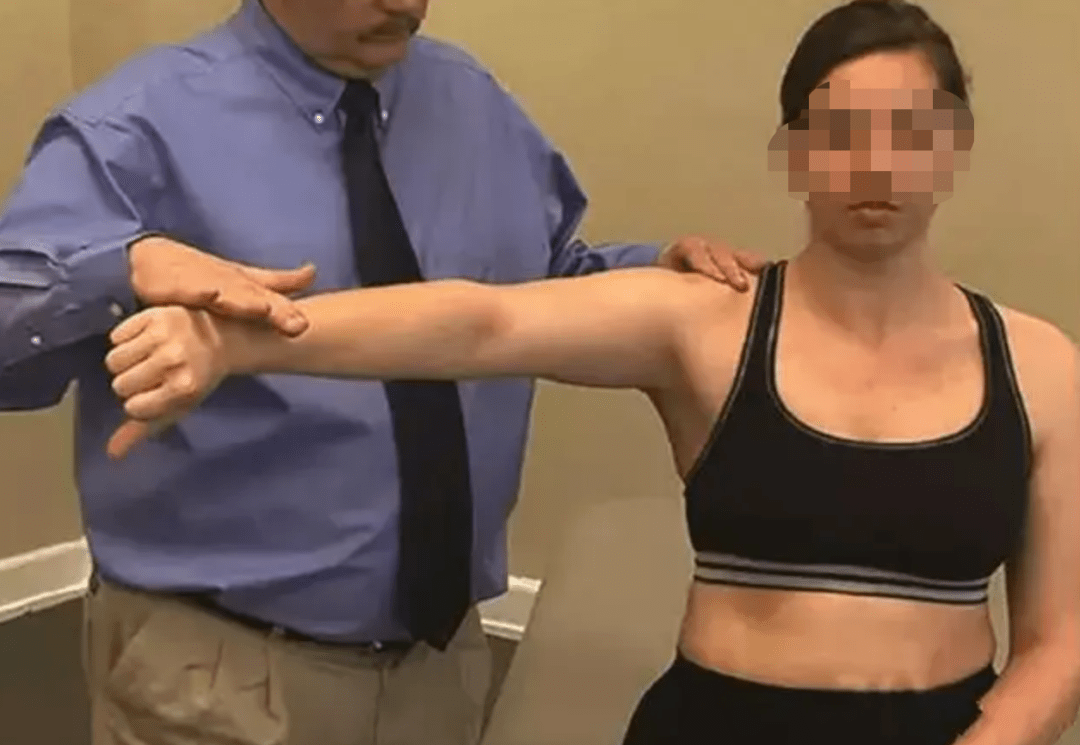 ▼ 特殊检查三:jobe 试验(空罐测试)