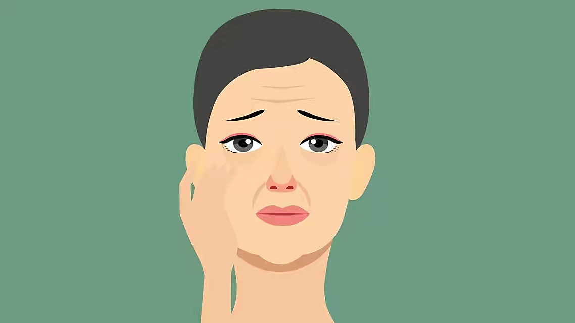 收缩和运动时,皮肤持续挤压所生成的皱纹,包括鱼尾纹,川字纹和抬头纹