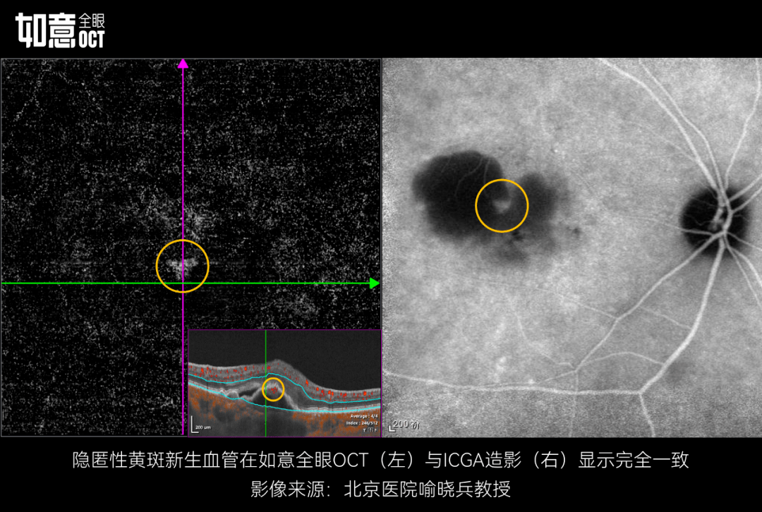 眼科oct报告单图片