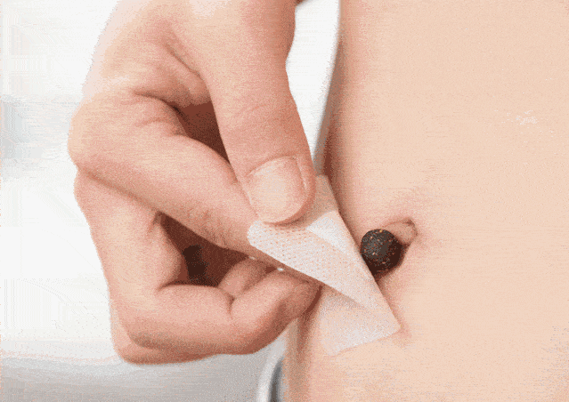 聪明人用花椒"敷肚脐",一个月后,3件好事可能悄悄"找上门"_身体_肠胃