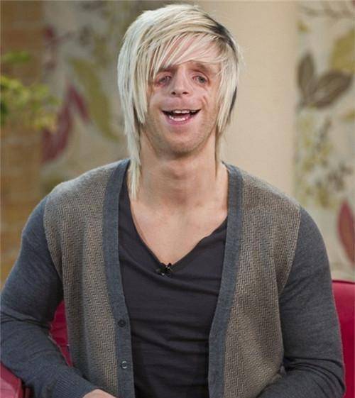 他先天面部畸形,凭才华迎娶娇妻,婚后孩子刚出生,两人当场傻眼_里昂