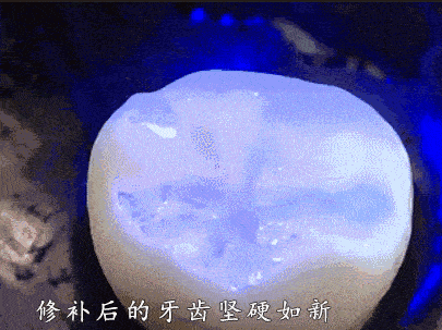 烂牙、缺牙有救了!美国发现“牙齿再 生液”,只需2滴,烂牙或许变新牙!_牙膏_口腔_再生