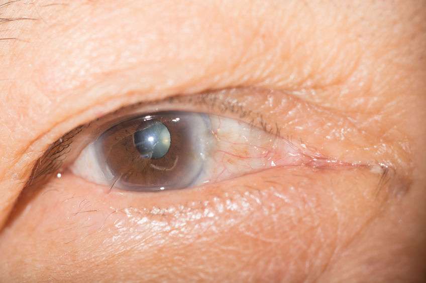 糖尿病患者,眼睛出现这5种不适,及时控制血糖,避免并发症