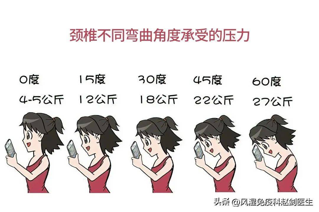 有了颈椎病怎么办?_椎间盘_症状_组织