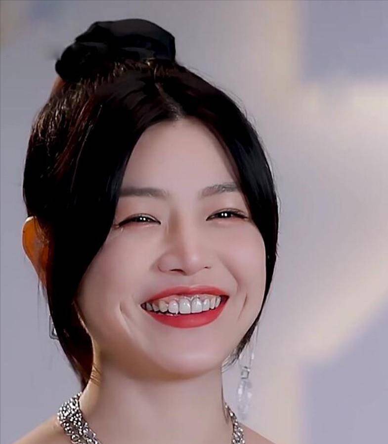 5位烤瓷牙明星,有的牙龈变灰,有的嘴包不住牙,一个比一个惨_刘涛_牙齿