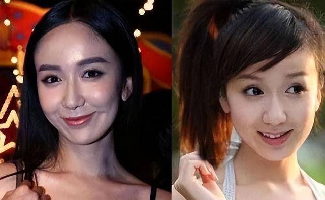 这6位整容失败的明星,个个断送大好前程,满脸玻尿酸太可惜了_张檬