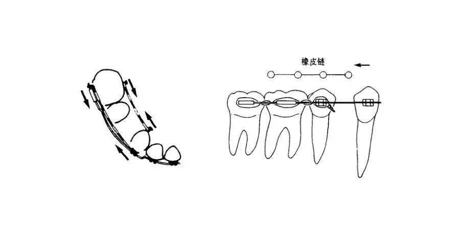 尖牙怎么画简笔画图片